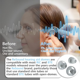 Resound Hearing aid Domes Open Comfortable Silicone Design Noise Reduction Enhanced Acoustics Breathable and Easy to Clean Resound Hearing Aid Accessories Jabra Hearing Aid Domes (Gray, Mix-12pcs)