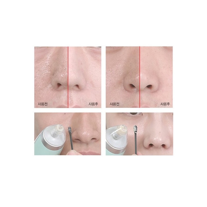 Cledbel Kill Pore Sebum Blackhead Pore Management Pore Device /