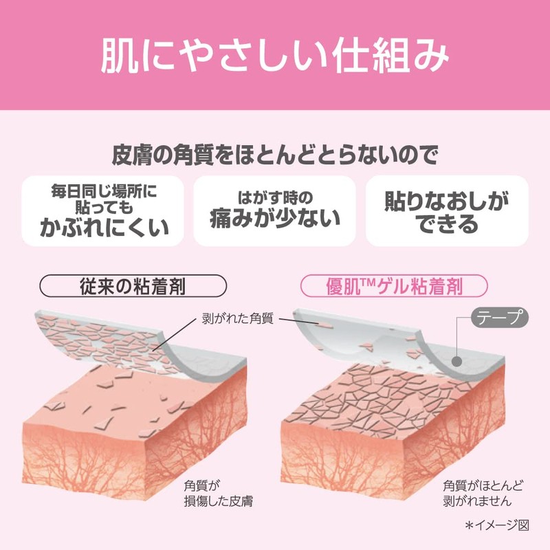 Nitoms Superior Skin Bond GS 1.0 inches (25 mm) x
