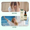 Lymphatic Drainage Drops, Lymphoria Drops, Lymphatic Drainage Drops, Lymphoria Lymphatic