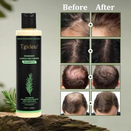 Tgideas Organic Rosemary Hair Growth Shampoo for Women and Men-Natural Thicke...