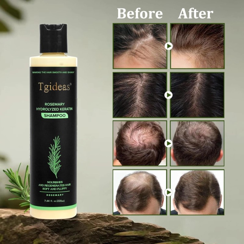Tgideas Organic Rosemary Hair Growth Shampoo for Women and Men-Natural