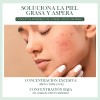 Sérum Oxyglow Con Ácido Láctico y Hialurónico Exfoliante Piel Grasa
