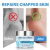 Uree-Creme 40 %, 60 ml Creme für sehr trockene und