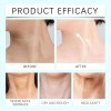 Parche Lifting Mascarilla Reafirmante Cuello