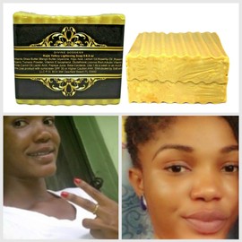Lemon-KBar | FOR Dark Spots, Fine Lines Kojic Acid, Turmeric,Clove & Glow Beauty Bar| Face & Body | Soap for oily skin and acne