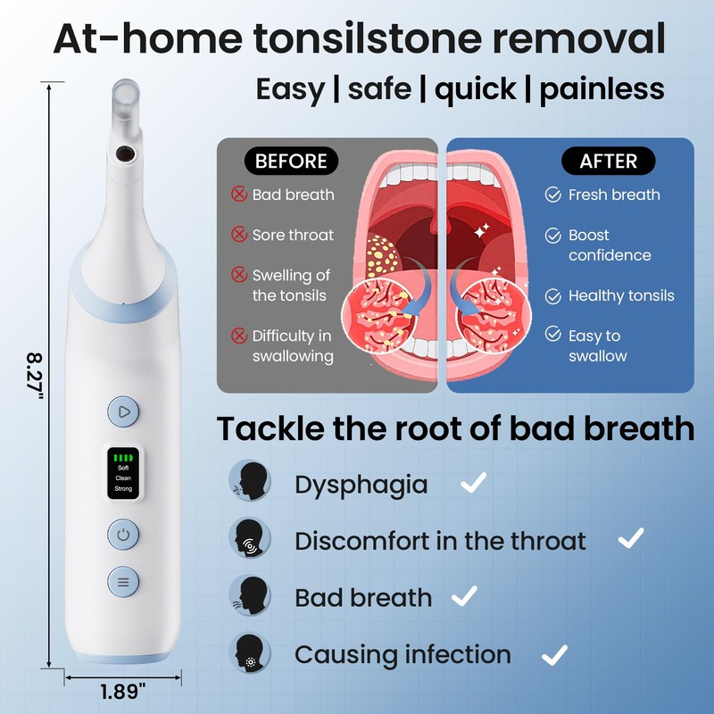 Tonsil Stone Remover with Camera,Electronic Tonsil Stone Removal Kit with