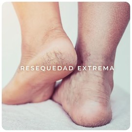 Derman DB Calm Emulsión Corporal │ Urea-D 10% + Ácido Hialurónico │ 400 mL