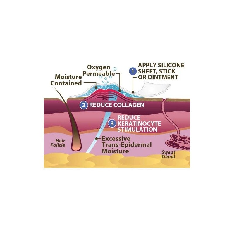 Scar Aid, tira de silicón grado médico, reduce cicatrices por