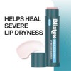 Blistex Medicated Lip Balm SPF 15, 3 Count | Paquete