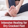 Kerasal Intensive Foot Repair, Skin Healing Ointment for Cracked Heels
