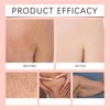 Aceite Corporal Revitalizante - Hidratación y Firmeza (3/4 Piezas)