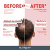 NUTRISANT Nutricap Hair Loss 30 Softgels - Stronger & Longer