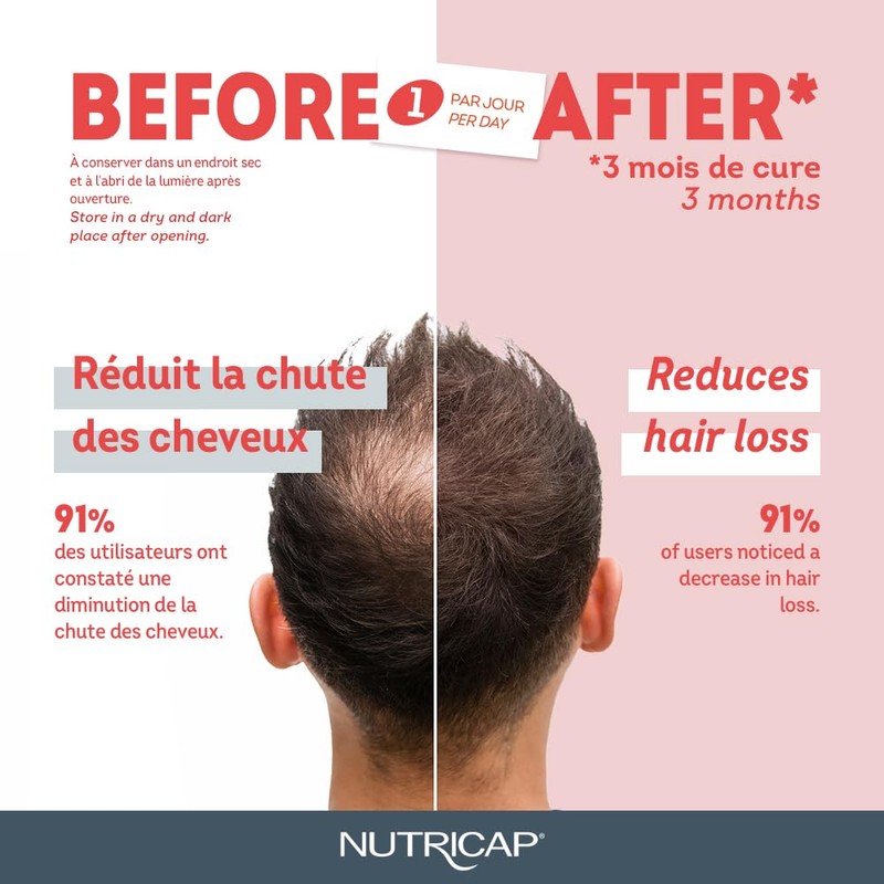 NUTRISANT Nutricap Hair Loss 30 Softgels - Stronger & Longer