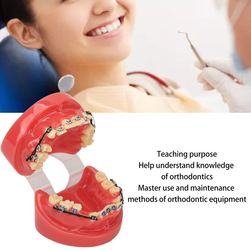 Professional Dental Demonstration Orthodontic Model with Metal Wires and Bracket
