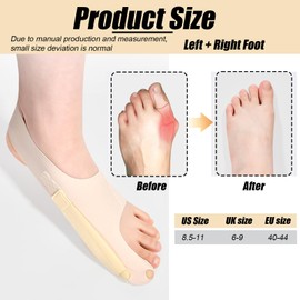 KUBDPQOR Hallux Valgus Correction, Pack of 2 Hallux Valgus Splint, Non-Slip Bunion Toe Separator, Hallux Valgus Shoes Women, Men, Bunion Corrector for Day/Night Support (L)