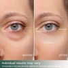 Eye Puffiness Dark Circle Under Eye Bags Fine Line Reduce
