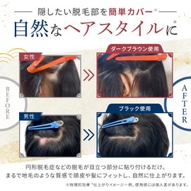 QAMOJI Hair Patch (Black) Wig Body + 30 Dedicated Seals Included Hair Areata Hair Enhancement Partial Wig Partial Wig