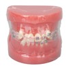 Demonstration Orthodontics Dental Model Disassembled Resin Teeth Model for Teaching