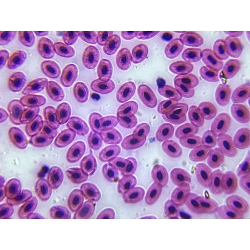 DIPLE Black&Fine Stage kit