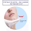 BIOAQUA Face Acne Treatment Scar Removal Spots Pimples Moisturizing Essential