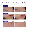 Mediheal Derma Clear Madecassoside Blemish Spot Patch (44 Counts) -