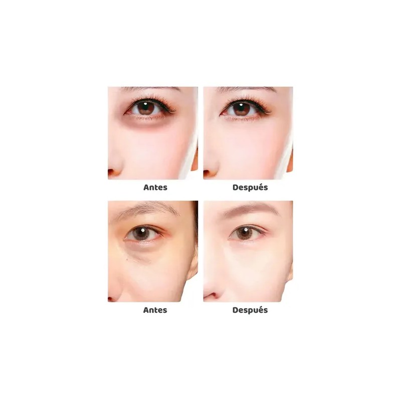 Pack sérum ácido hialurónico B5 parches de ojos Ácido Hialurónico