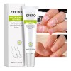 Compuesto completo para tratamiento de tiña Efero Nails, color blanco