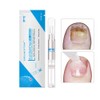 Fungus Nail Repair Pen Toenails, Nail Biological Repair Pencil, Repairs