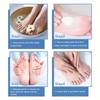 Grospe Urea Cream 45 Percent for Feet Maximum Strength, Moisturizes