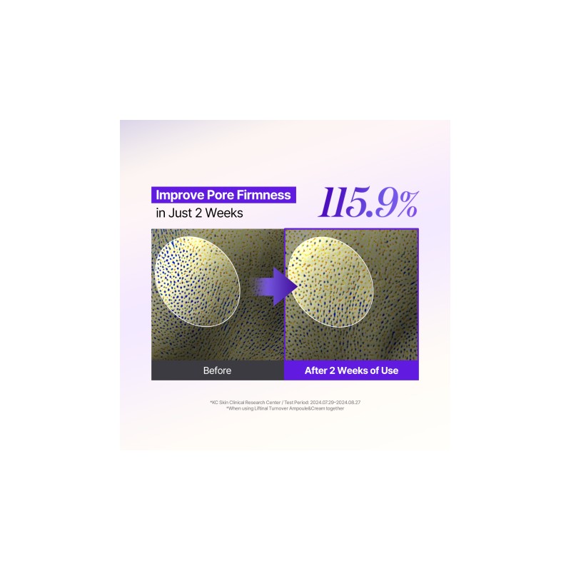 MILDLAB [MILDLAB]5 EGF Retinal Liftinal Turnover Ampoule 30ml