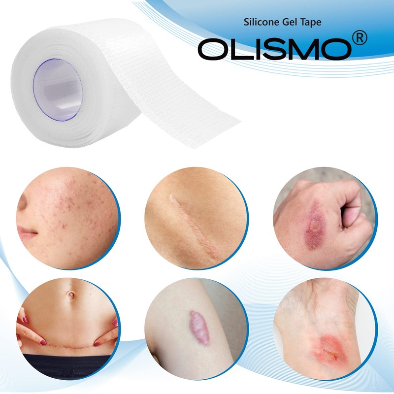手術後 帝王切開 傷あ 米国式デザインテスト シリコーンゲルテープ ４センチ×150 センチ, ４センチ×300 センチ (４センチ×１５０センチ)