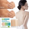Rollo Cinta Silicona Para Reduccion Cicatrices Marcas Piel