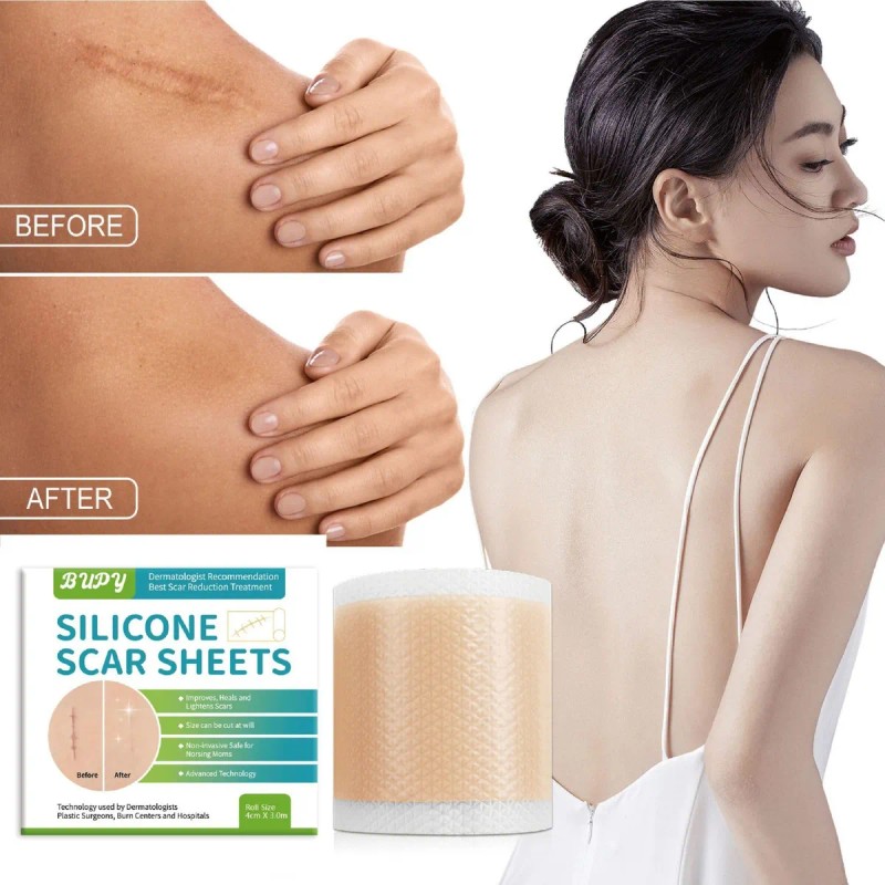 Rollo Cinta Silicona Para Reduccion Cicatrices Marcas Piel