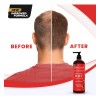 Dht Blocker Champú Anti-pérdida De Cabello Con Biotina