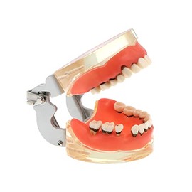 Modelo de dientes dentales para enfermedad periodontal parodontopatía, modelo de dientes de patología de gingivae extraíble utilizado en enseñanza, explicación, estudio para adultos (transparente)