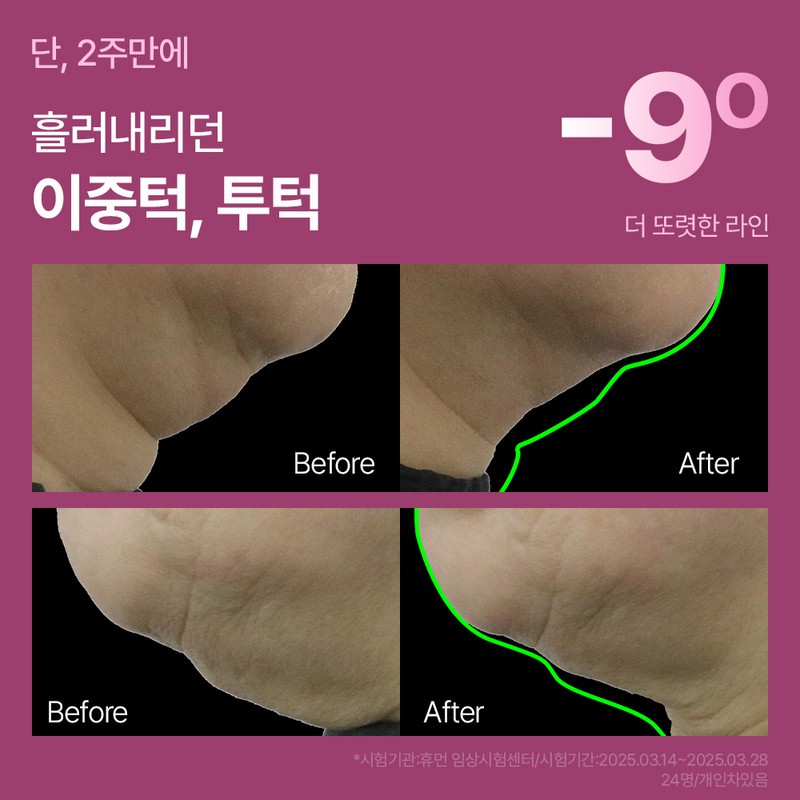 The Medi Doctor Double chin guasha massage / Shrink cream