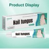 Ungüento Para Hongos En Las Uñas Tratamiento Efectivo 20g