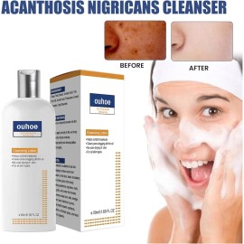 Jabón Facial Antimanchas Y Antiacné Limpieza Profunda 50 Ml