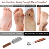 Colossal Foot Rasp & Wood Handle Callus Shaver (10 Replacement