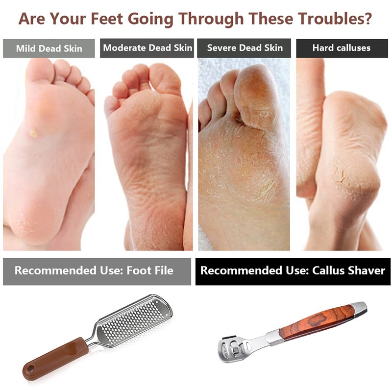 Colossal Foot Rasp & Wood Handle Callus Shaver (10 Replacement