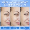 Collagen Mask, Overnight, Deep Moisturising Anti-Wrinkle Lifting, Hydrogel Mask for