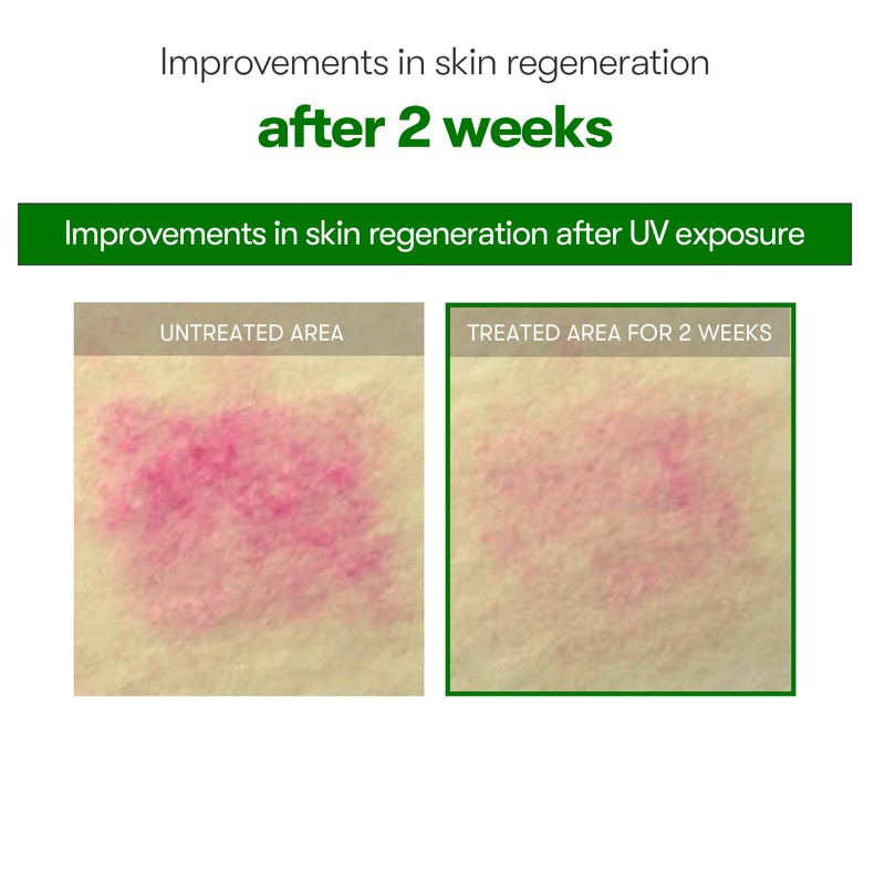 VT Cosmetics [VT Cosmetics]Reedle Shot 700