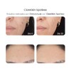 Reve Clareskin Spotless Suero Facial Despigmentante 30ml Piel Mixta Día/noche