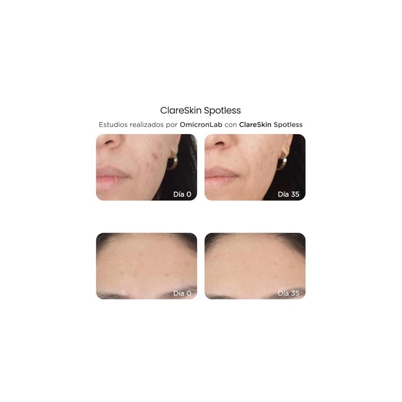 Reve Clareskin Spotless Suero Facial Despigmentante 30ml Piel Mixta Día/noche