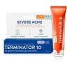 Acnefree Terminator 10 Acne Severo Con Peróxido De Benzoylo Tipo