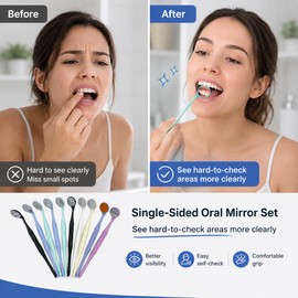 10-Pack Dental Mirror Set for Oral Inspection – High-Definition Mouth Mirrors for Teeth, Pets & Beauty Use