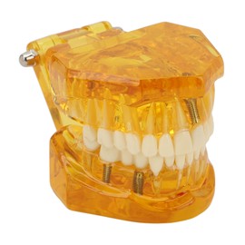 Dental Pathological Model Clear Structure Educational Teeth Display Model Transparent Yellow