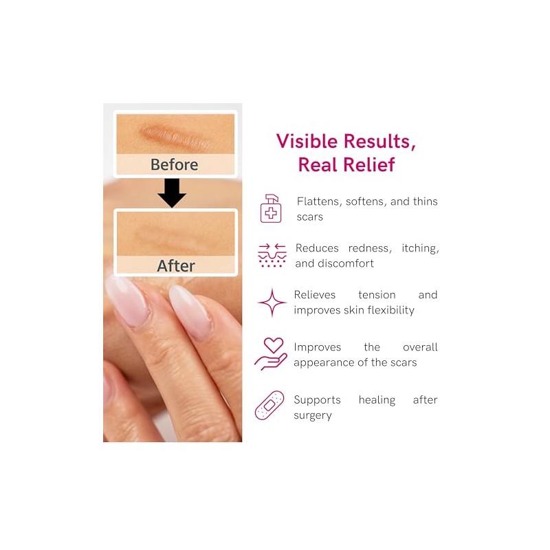 Gel LIPOELÁSTICO de silicona cicatriz - Cuidado eficaz para cicatrices
