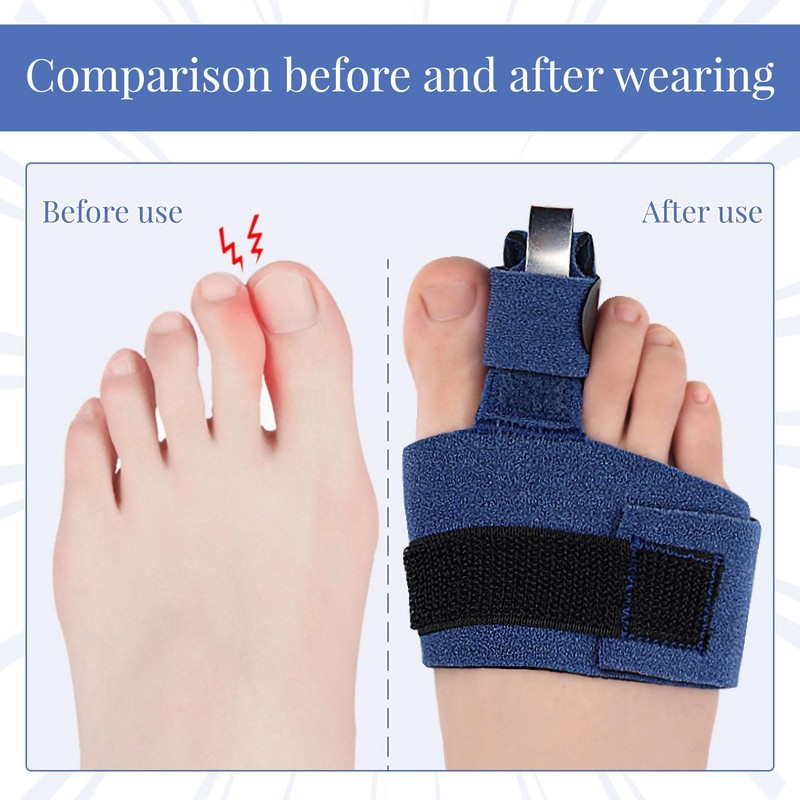 2PCS Adjustable Toe Splints for Straightening,Hammer Toe Straightener with Metal